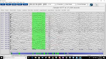 Editing Demonstration #1