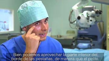 ¿Debo masajear las cicatrices de la blefaroplastia?