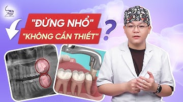 GIẢI ĐÁP THẮC MẮC VỀ RĂNG KHÔN MỌC THẲNG | CÓ CẦN THIẾT PHẢI NHỔ HAY KHÔNG?