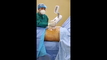 Giải Pháp Giảm Mỡ Cứng Đầu Hiệu Quả Nhất Không Cần Phẫu Thuật - Chỉ 60 Phút Với Liposonix