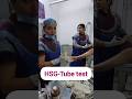 HSG Tube Test