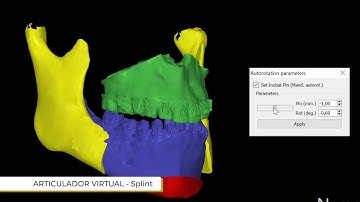 Virtual Articulator- Analyze dental occlusion