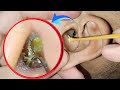 Unbelievable Ear Cleaning Transformation | Real Earwax Removal ASMR | EP 129