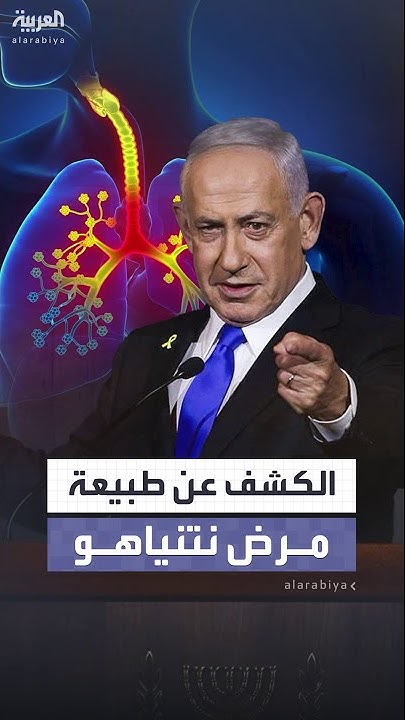      
 - نشر قبل 2 ساعة