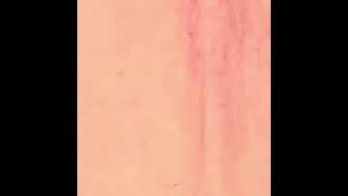 Zalmon - Ratok Padi ampo