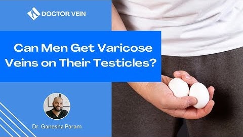 Can You Get Varicose Veins on Your Testicles?