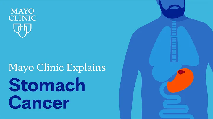 Mayo Clinic explains stomach cancer - DayDayNews