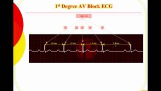 Junctional Rhythms