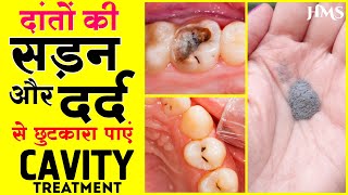 दांतों की सड़न और दर्द से  छुटकारा पाएं | Tooth Cavity & Pain Natural remedies