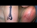 'Black Henna' Tattoo Causes Allergic Reaction to Skin That Leaves a Scar For Life!