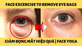 Xóa bọng mắt | 14 ngày tập face yoga giảm bọng mắt | Bài tập mặt xóa bọng mắt hiệu quả tại nhà!