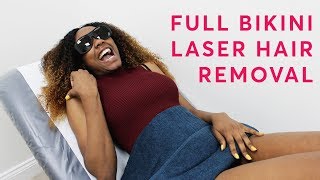 Full Bikini And Peri - Laser Hair Removal Live Treatment
