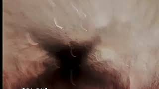 Sewer Lateral Replacement
