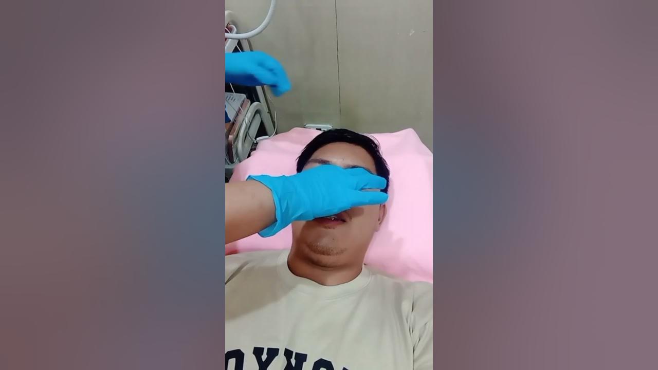 Alartox, After Hiko Nose Lift YouTube