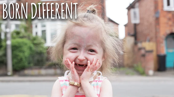 The Only Girl In The World With 'Benjamin Button' ...