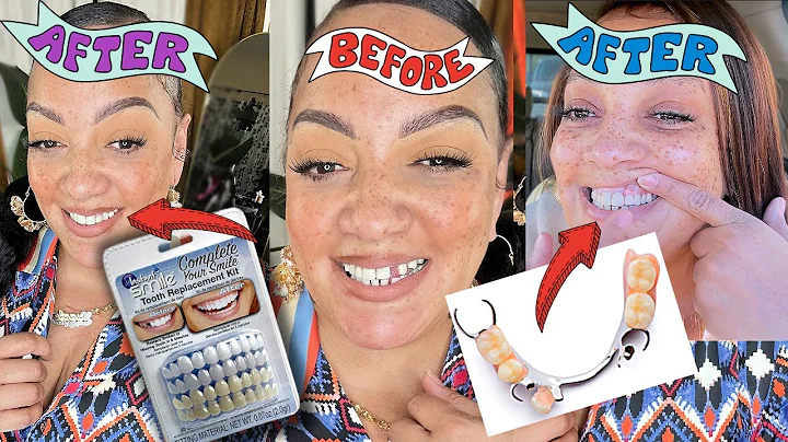 I Bought A Tooth From Amazon |How I Fixed My Missing Front Tooth for Cheap