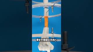 骨の再生