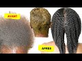 Pourquoi le Henna Assèche Tes Cheveux Crépus - Solution Contre Cheveux Secs Due Au Henna