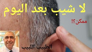 لا شيب بعد الآن..... ممكن؟