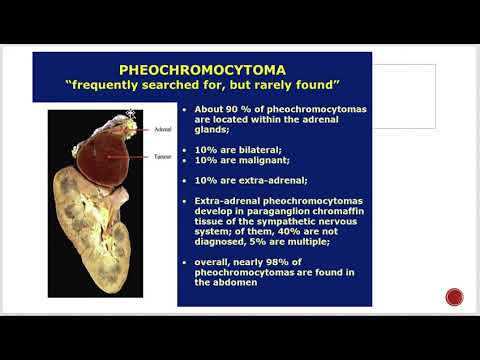 Pheochromocytoma Diabetes insipidus and psychogenic polydipsia