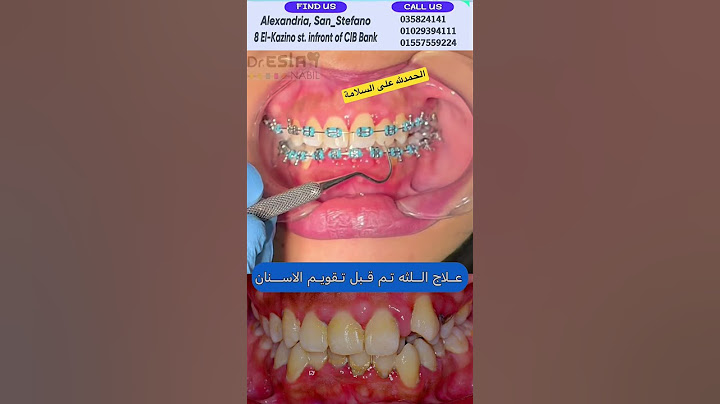 الحمدلله على السلامة