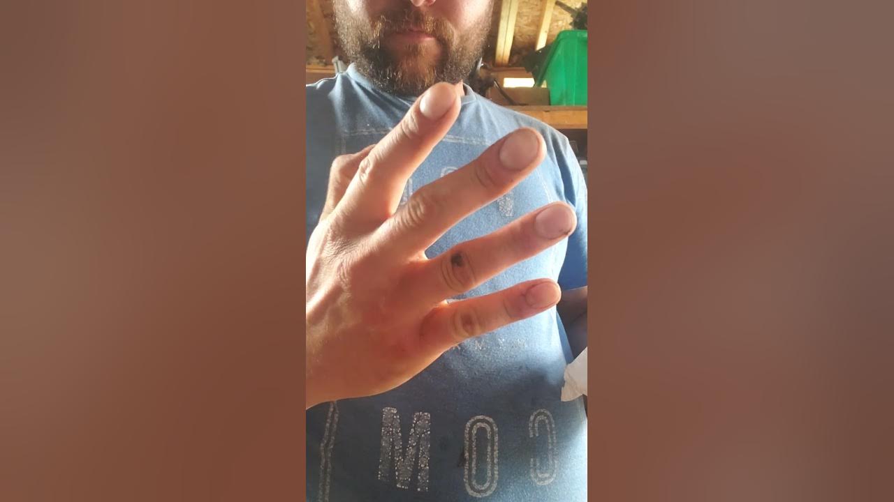 how to remove roofing tar on your hands or siding YouTube