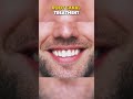 Root Canal Treatment 3D Animation #medical #medical3d #root #rootcanal #rootcanaltreatment #rootcan