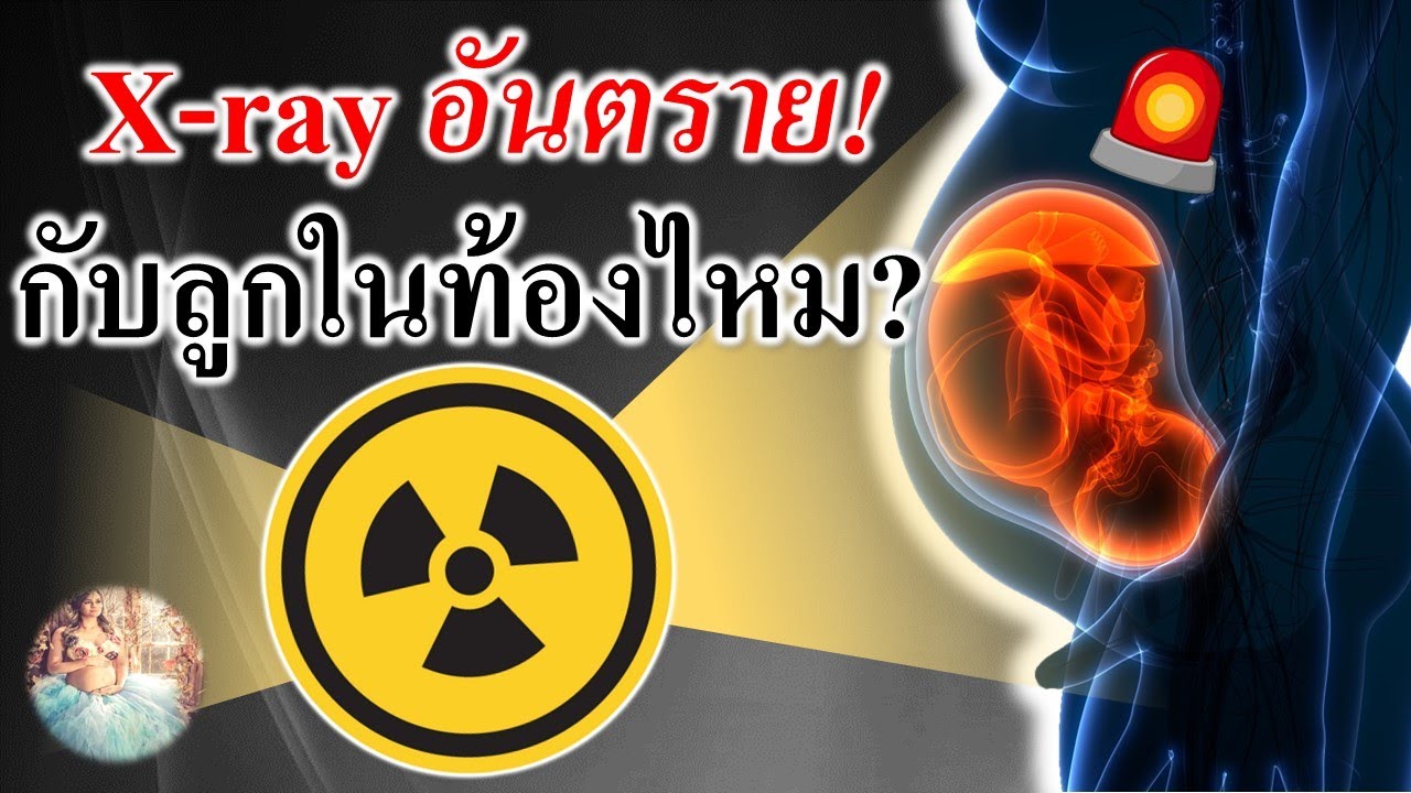 พัฒนาการทารกในครรภ์ : X ray อันตรายกับลูกในท้องหรือไม่ ?| เด็กในท้อง | คนท้อง Everything