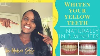 Exclusive Whiten your Teeth Naturally at Home in 3 Minutes with this recipe Details