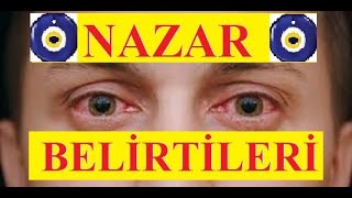 nazar belirtileri uzerimizde nazar oldugunu nasil anlariz nazar degmesi nazar nazarbelirtileri youtube