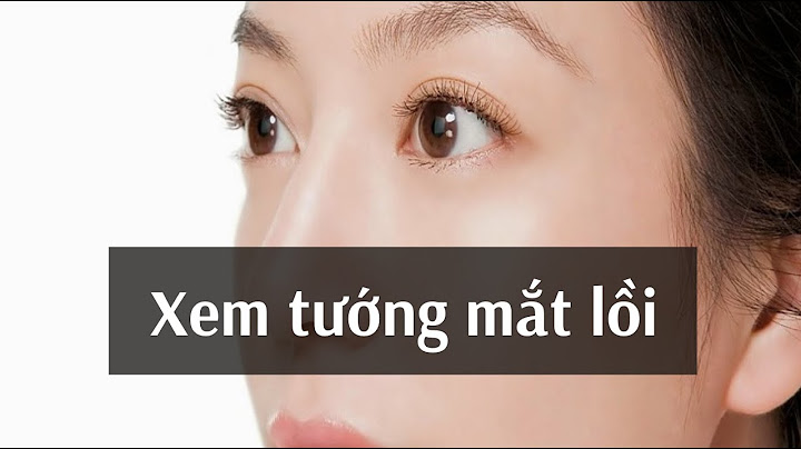 Con gái mắt lồi thì tính cách như thế nào