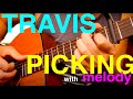 Adding melody to travis picking fingerpicking guitar lesson