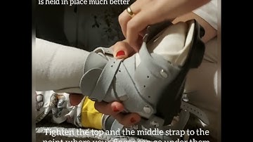 How to put on Mitchell boots and bar - Ponseti Orthosis - Clubfoot Brace