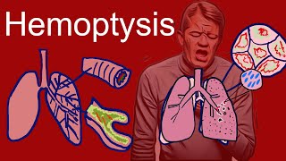 Hemoptysis (Coughing Up Blood) - Causes, types, symptoms