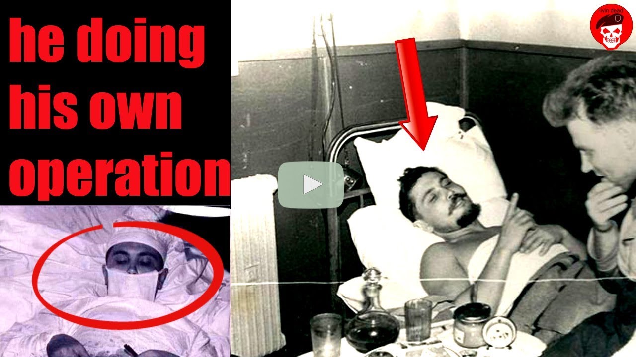 A Doctor Who Did His Own Appendix Operation a-doctor-who-did-his-own-appendix-operation