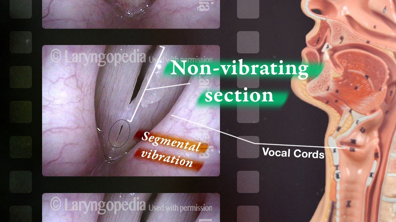 Tin Whistle Segmental Vibration Of The Vocal Cords YouTube Tin Whistle Segmental Vibration Of The Vocal Cords YouTube