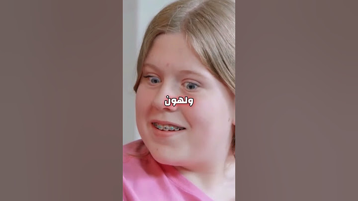 مستر بيست طلع سيء جدا بعد الي صار ؟!!