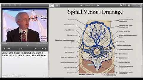 CCSVI Web Forum Part 8 of 14  April 2010  American Academy of Neurology  National MS Society