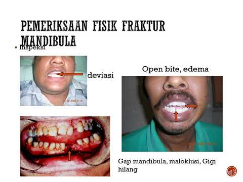 kuliah trauma maksilofacial