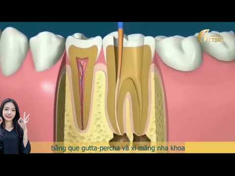 Video Bạn Có Muốn Biết Tại Sao Phải Điều Trị Tuỷ? Điều Trị... - youtube