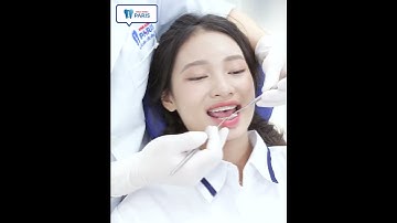 "Sau khi niềng răng mình tự tin hơn"