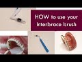 HOW to use your interbrace brush  |  Dr. Jiten Vadukul  |  The Orthodontist