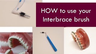 HOW to use your interbrace brush  |  Dr. Jiten Vadukul  |  The Orthodontist