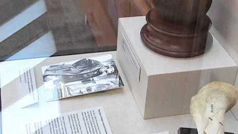 Amputated leg of Civil War general on display at F...