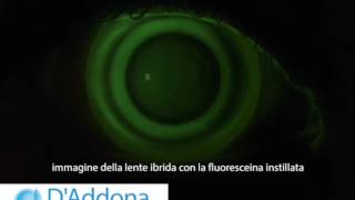 LENTI A CONTATTO IBRIDE - D'ADDONA VISION CARE