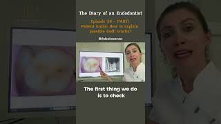 Famous Patient Guide: How to explain possible tooth cracks? Part 1 Net Worth