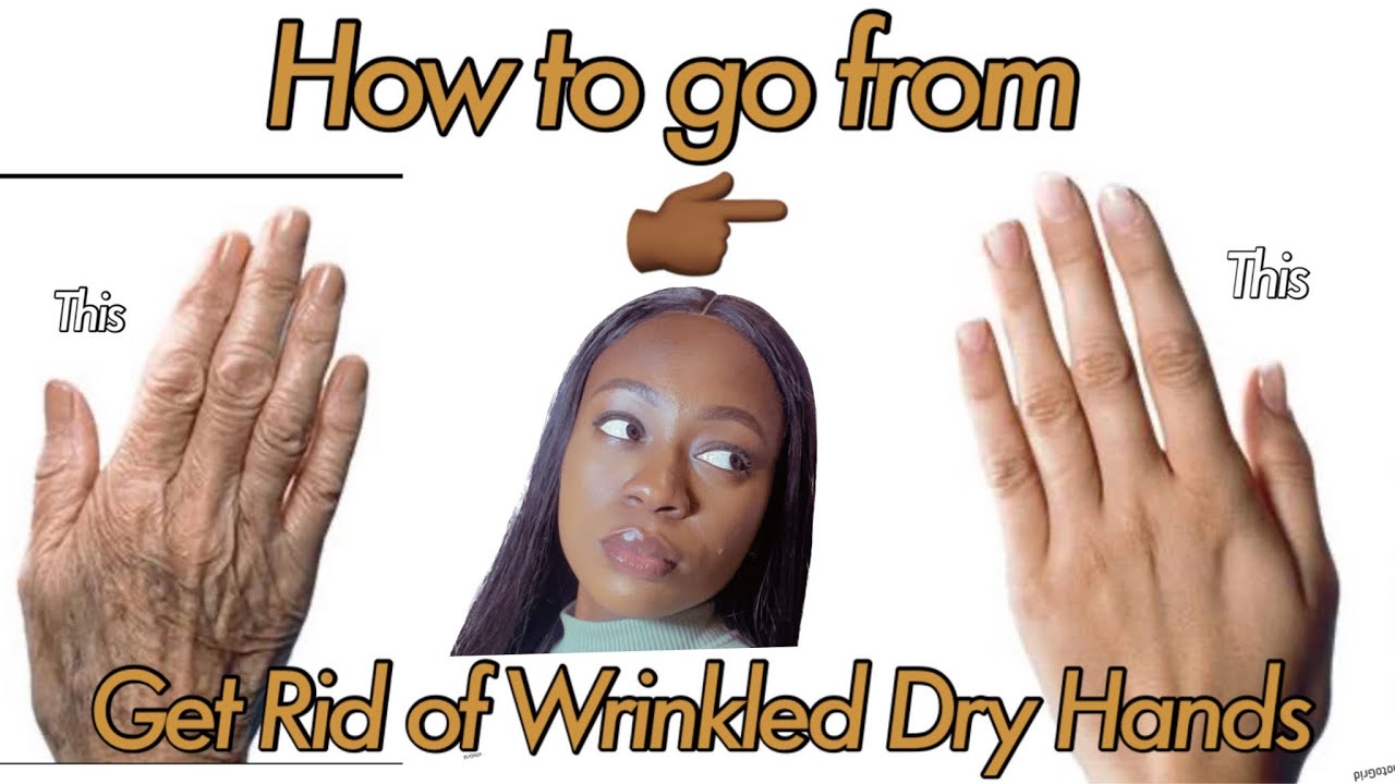 HOW TO STOP AGING HANDS, REDUCE WRINKLES,DRYNESS,HYPERPIGMENTATION AND