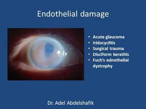 Video: Modelare Cornea