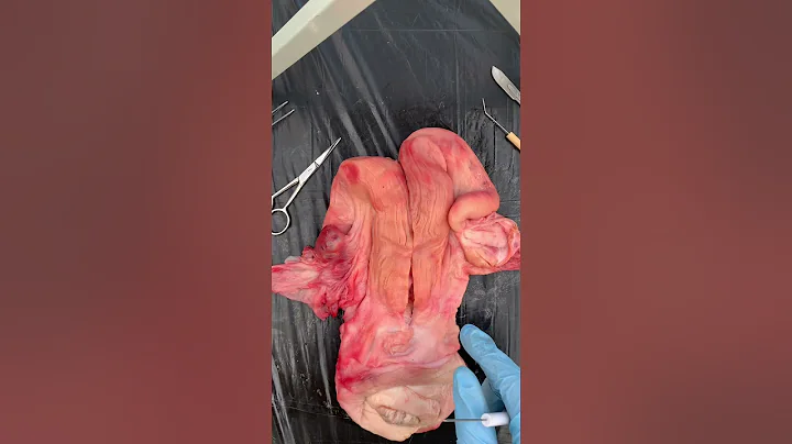 Bovine Uterus Dissection