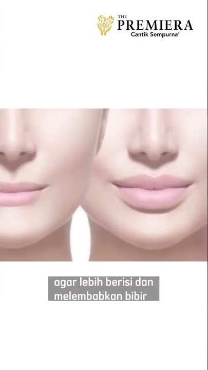 Filler Bibir Efektif Gak Ya? Untuk Tahu Lebih Detail, Simak Sampai Akhir Ya